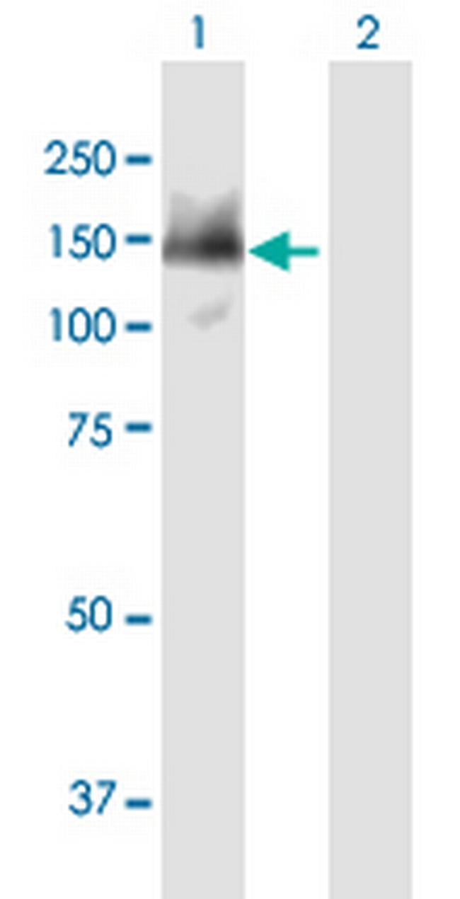 SMARCAD1 Antibody in Western Blot (WB)