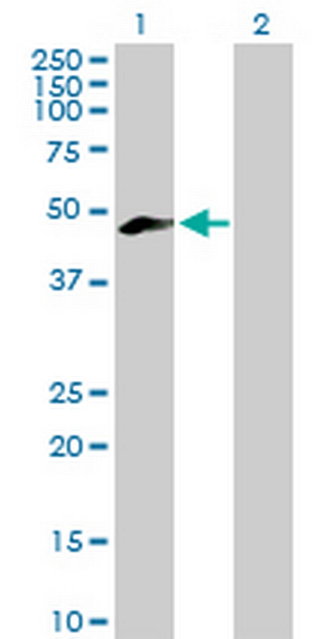 MEIS3 Antibody in Western Blot (WB)
