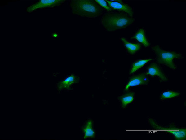 PAK6 Antibody in Immunocytochemistry (ICC/IF)