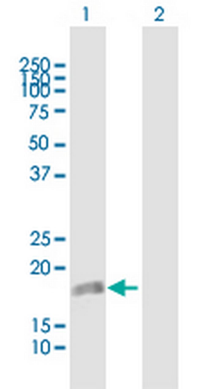 DUSP22 Antibody in Western Blot (WB)