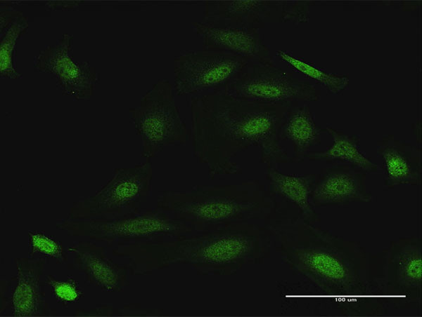 DUSP22 Antibody in Immunocytochemistry (ICC/IF)