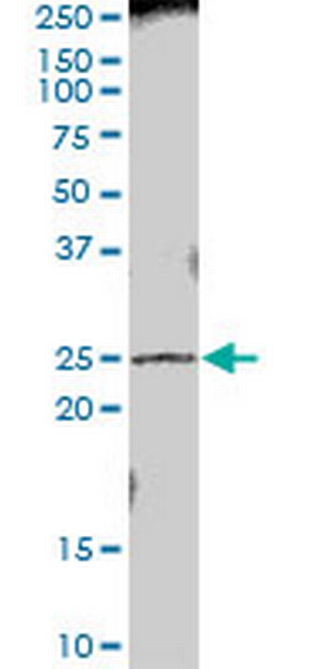 PRTFDC1 Antibody in Western Blot (WB)