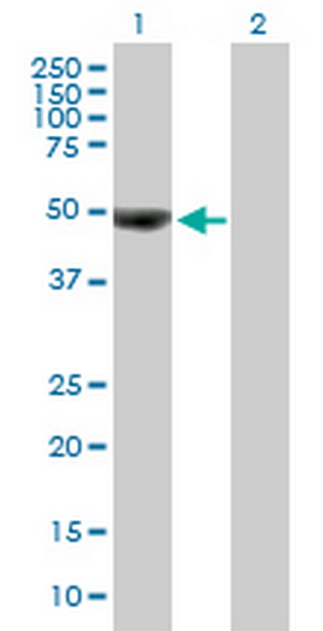OTUD7B Antibody in Western Blot (WB)