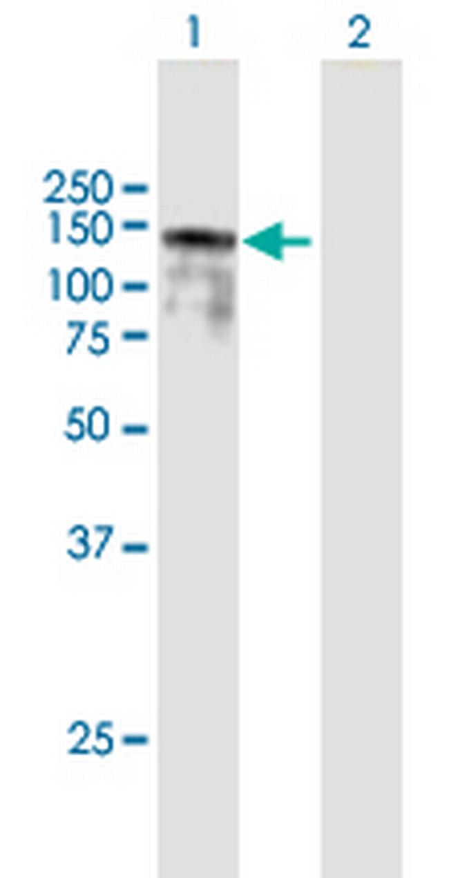 BBX Antibody in Western Blot (WB)