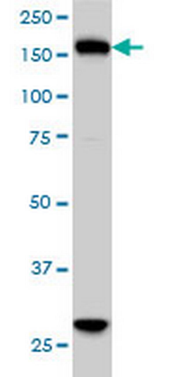 KIF15 Antibody in Western Blot (WB)