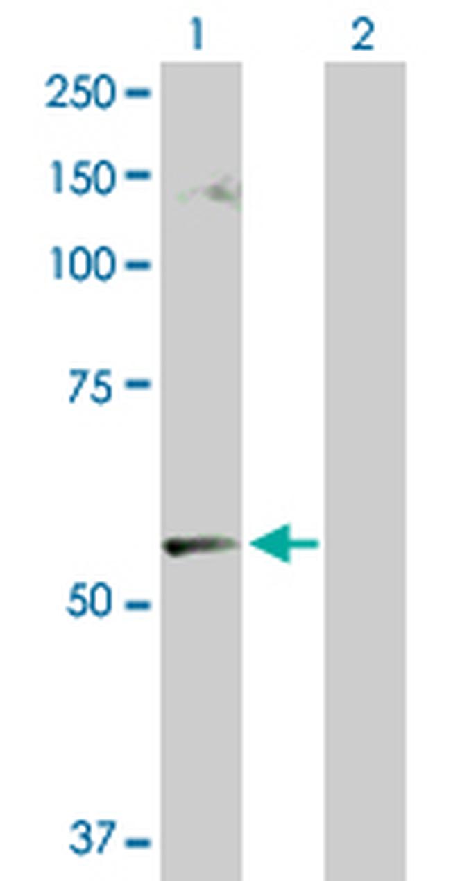 CABC1 Antibody in Western Blot (WB)