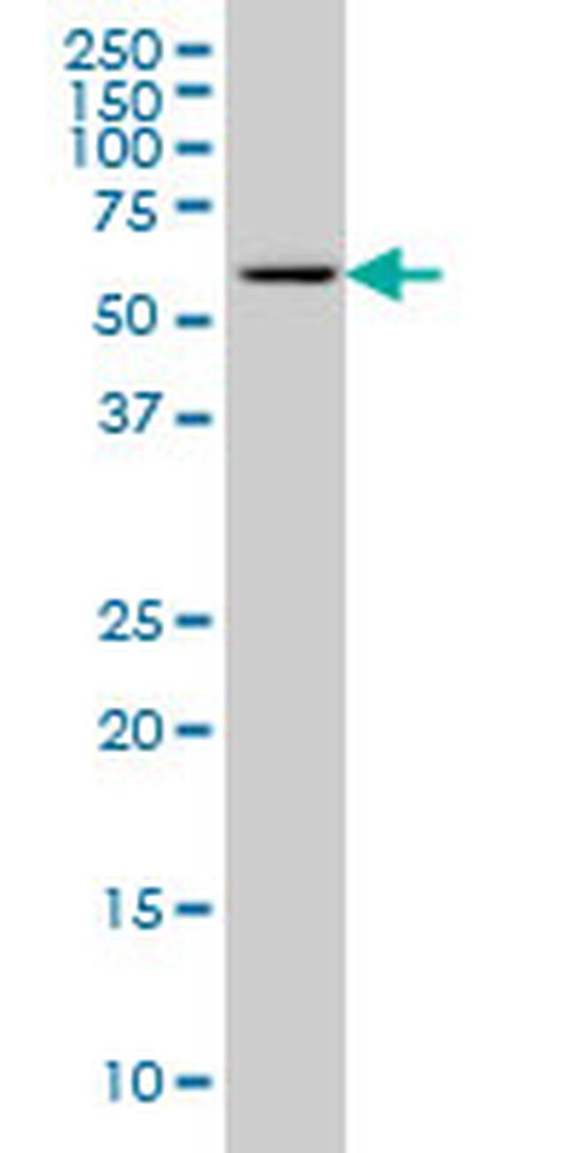 CABC1 Antibody in Western Blot (WB)