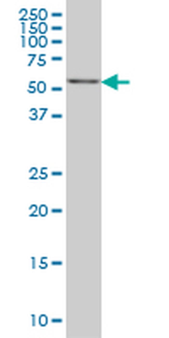 CABC1 Antibody in Western Blot (WB)