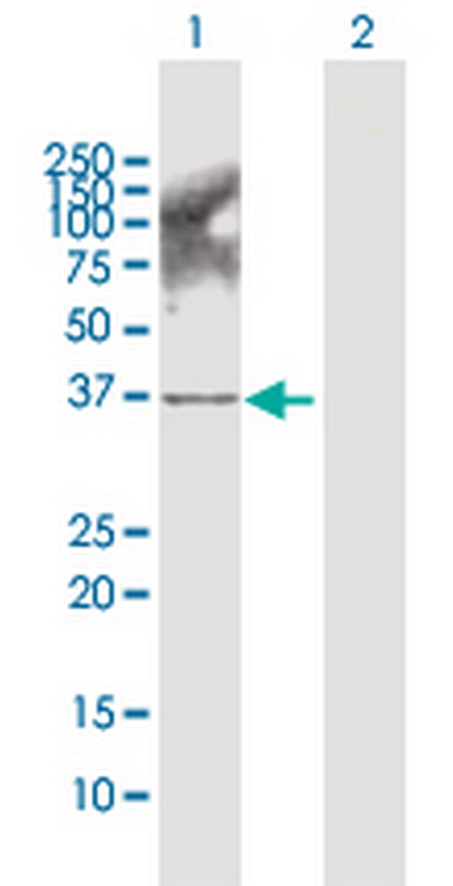 AKR1B10 Antibody in Western Blot (WB)