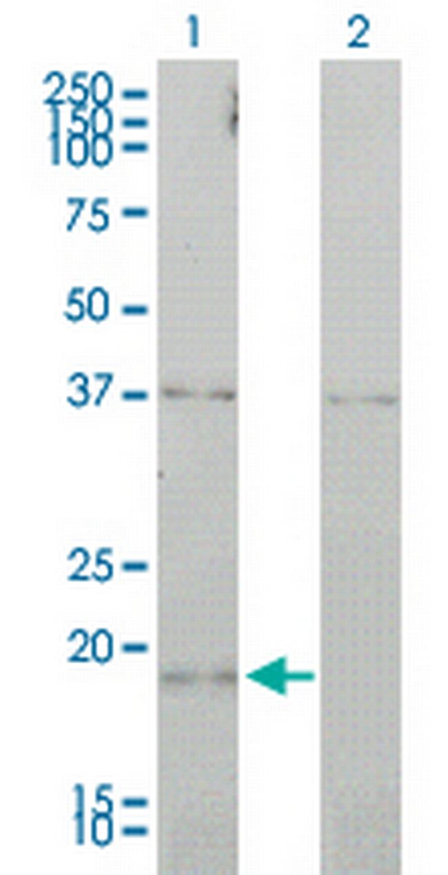 CCNL1 Antibody in Western Blot (WB)