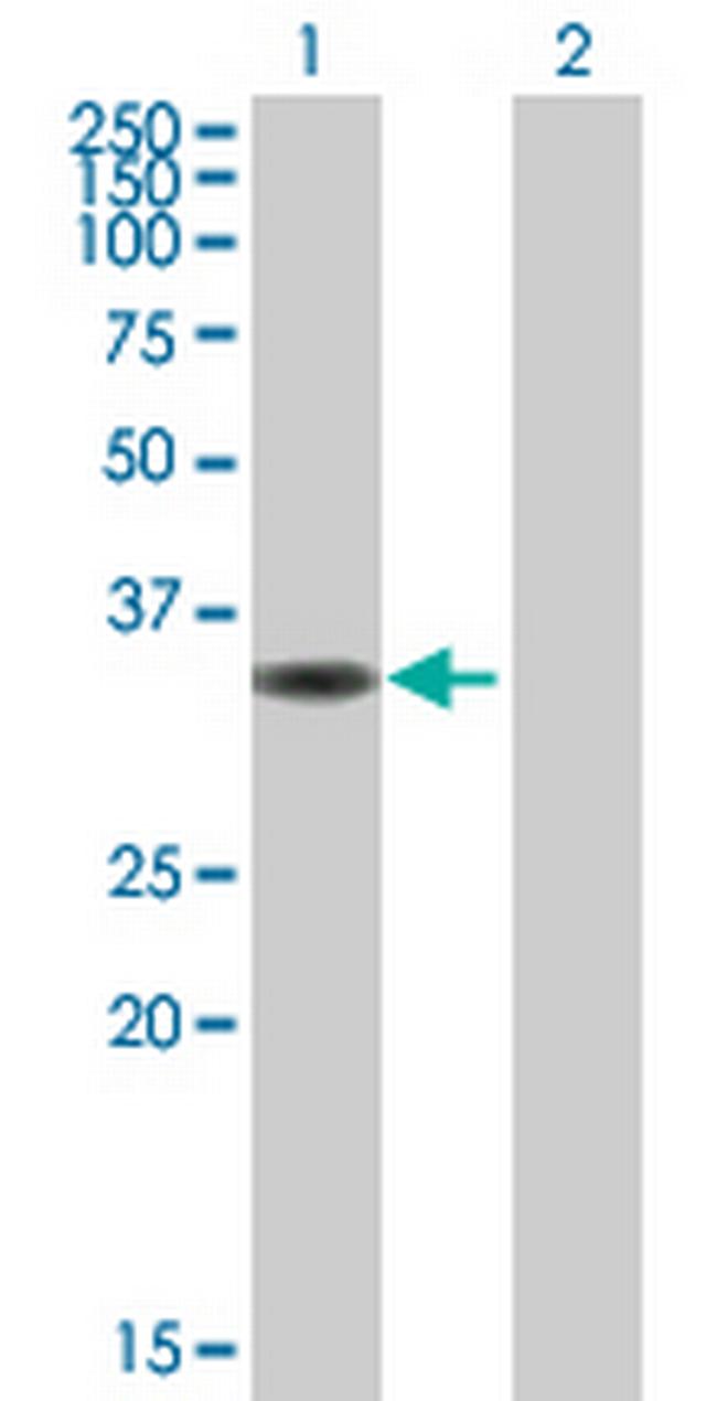 CIAPIN1 Antibody in Western Blot (WB)