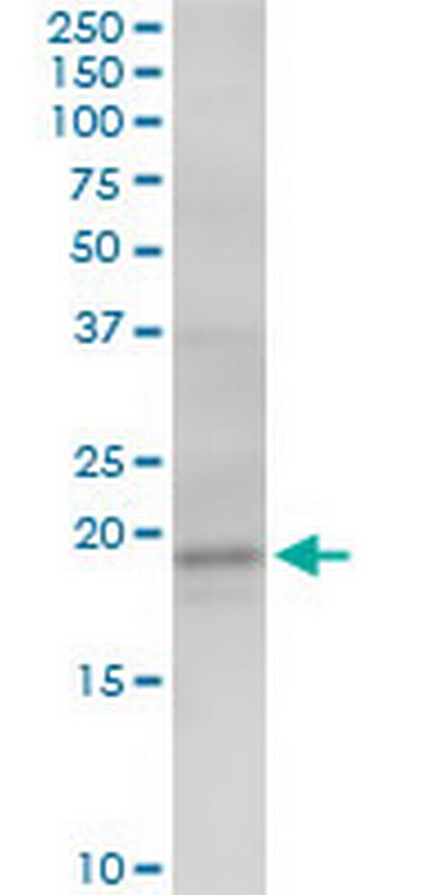 AGTRAP Antibody in Western Blot (WB)