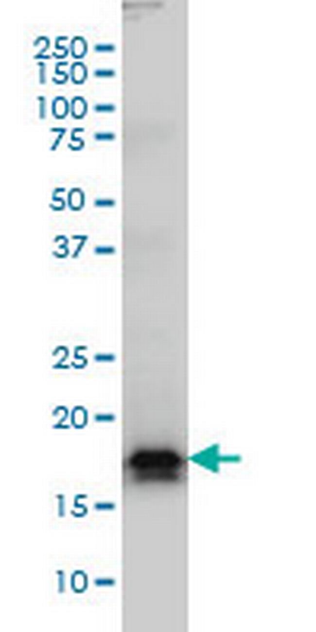 AGTRAP Antibody in Western Blot (WB)