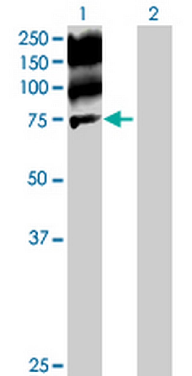 C20orf32 Antibody in Western Blot (WB)