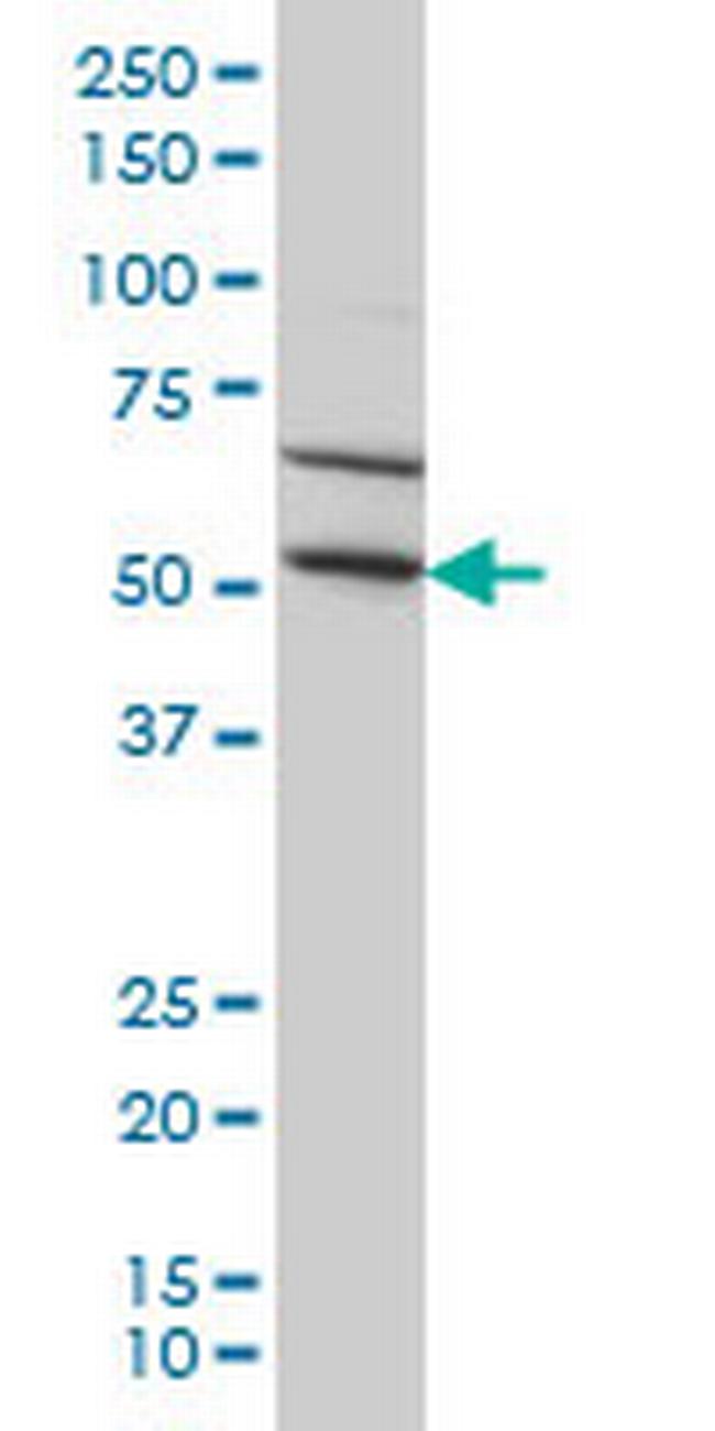 TRIM49 Antibody in Western Blot (WB)