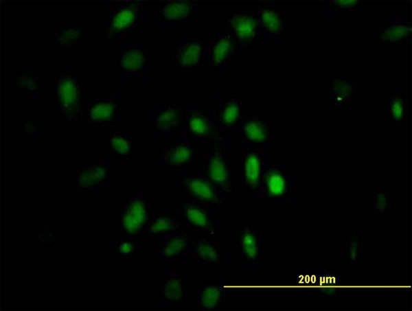 TRIM49 Antibody in Immunocytochemistry (ICC/IF)
