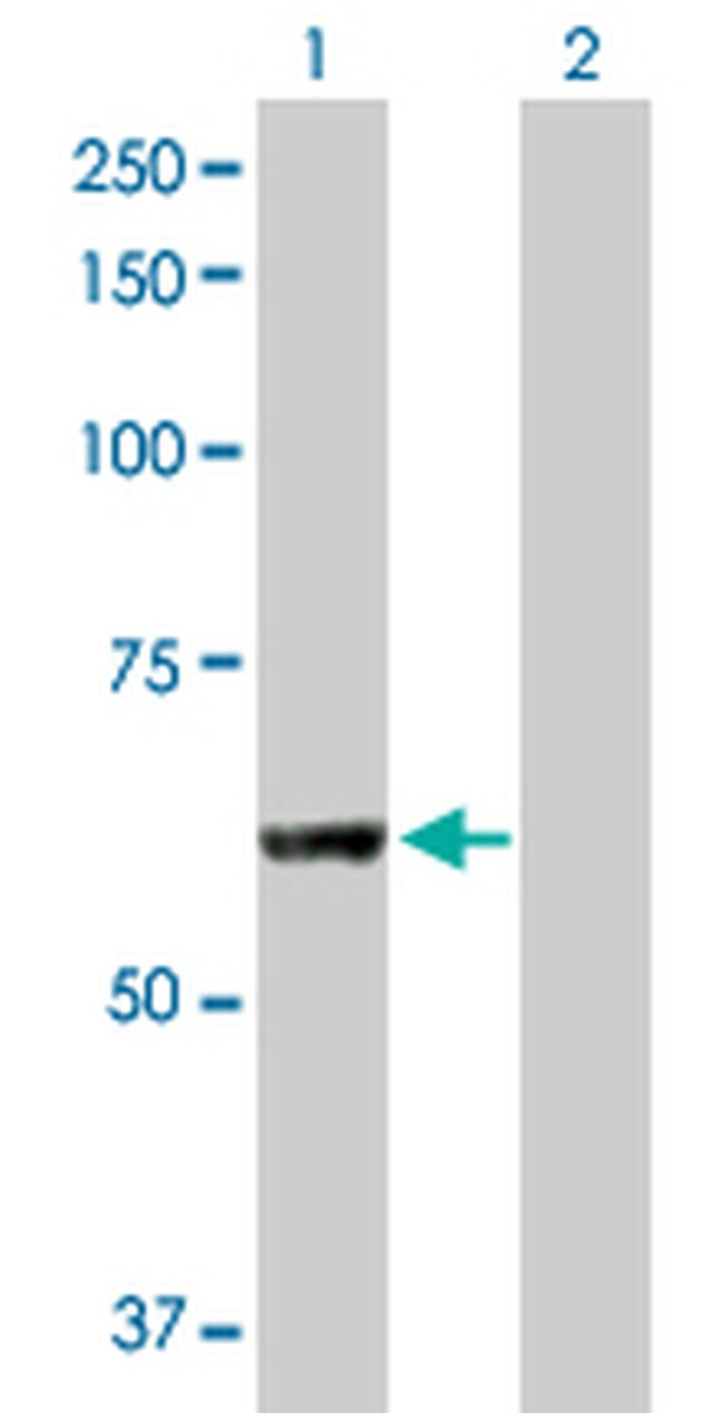PNPLA2 Antibody in Western Blot (WB)