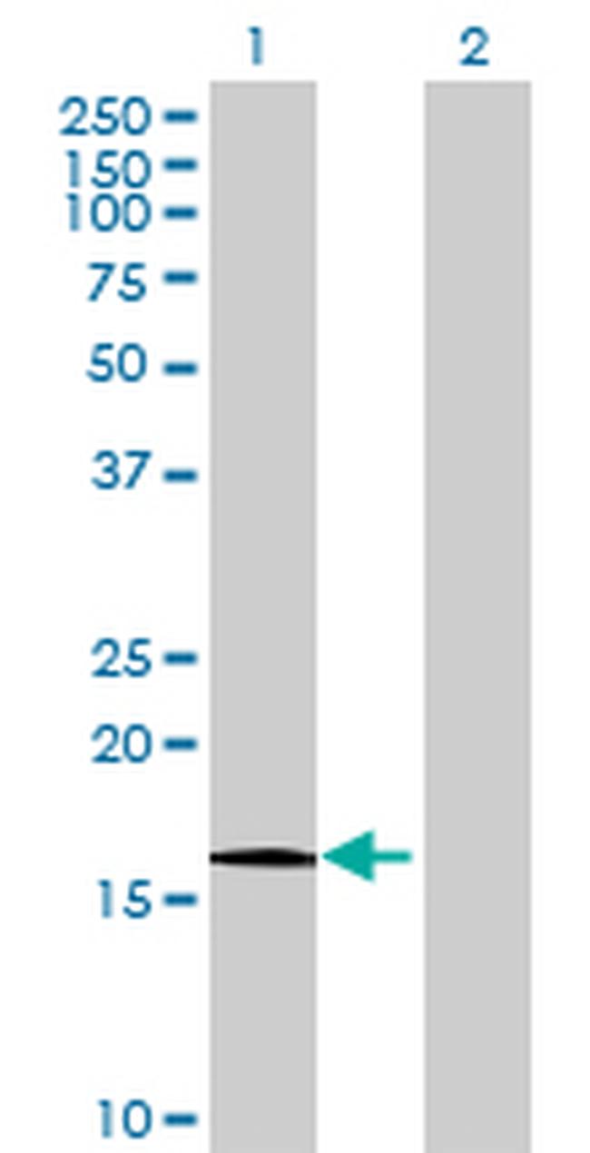 HRASLS Antibody in Western Blot (WB)