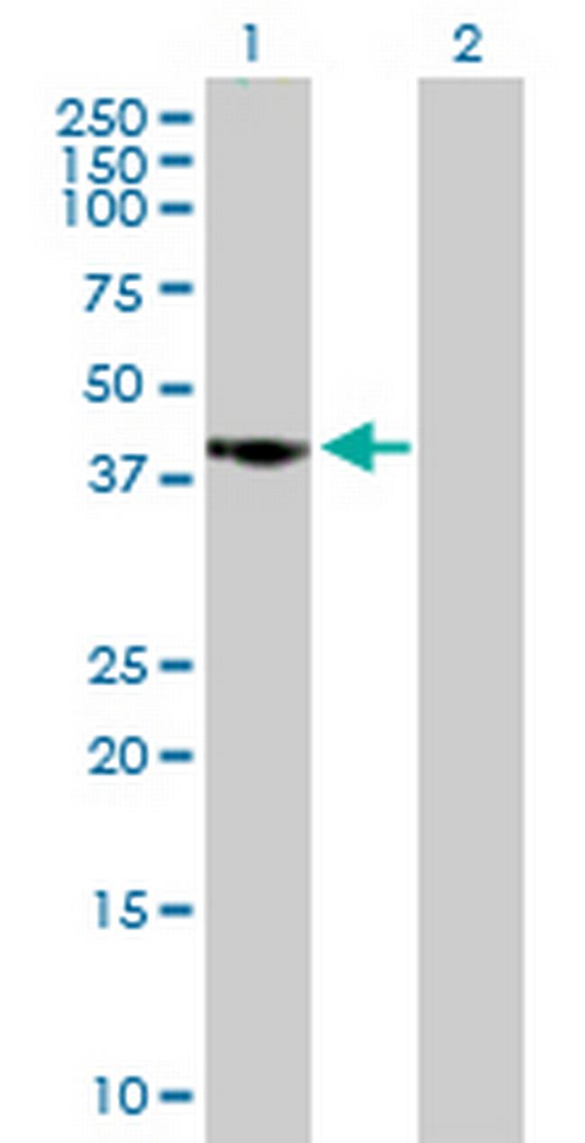 CAMK1D Antibody in Western Blot (WB)