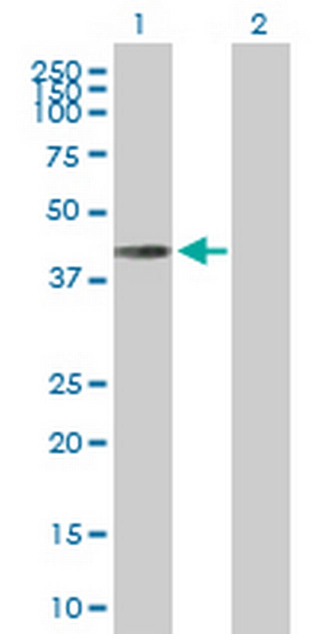 CAMK1D Antibody in Western Blot (WB)