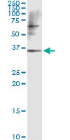 CAMK1D Antibody in Immunoprecipitation (IP)