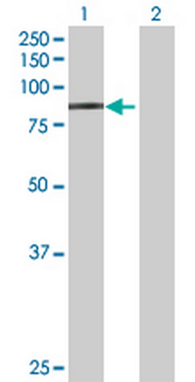 CD248 Antibody in Western Blot (WB)