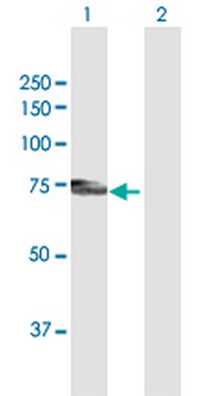 PLXDC1 Antibody in Western Blot (WB)