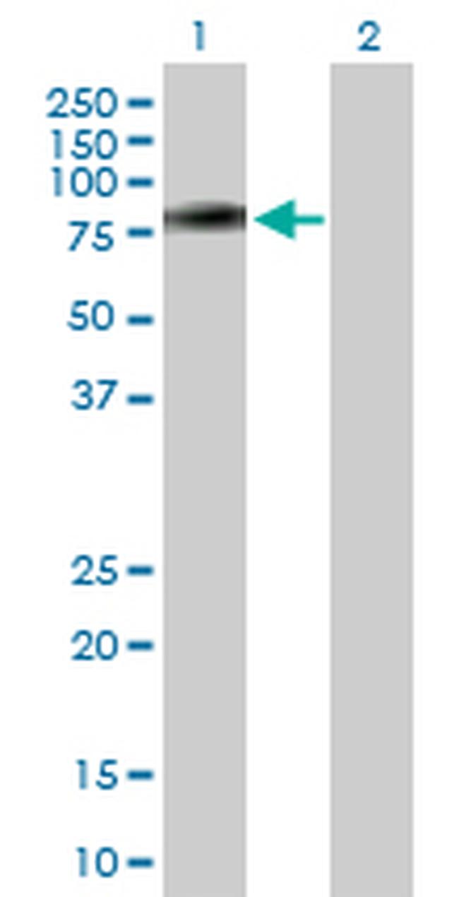 PLXDC1 Antibody in Western Blot (WB)