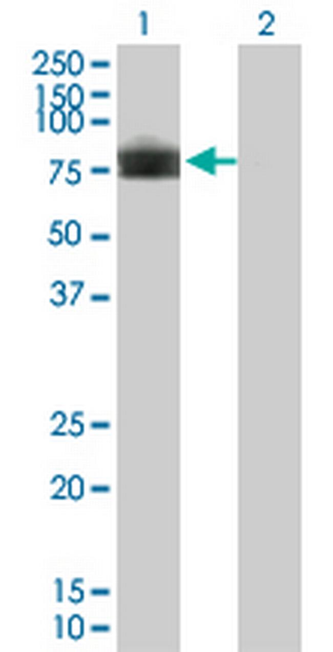 PLXDC1 Antibody in Western Blot (WB)