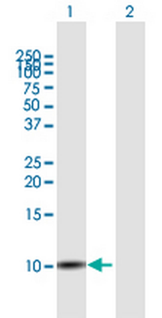 SLURP1 Antibody in Western Blot (WB)