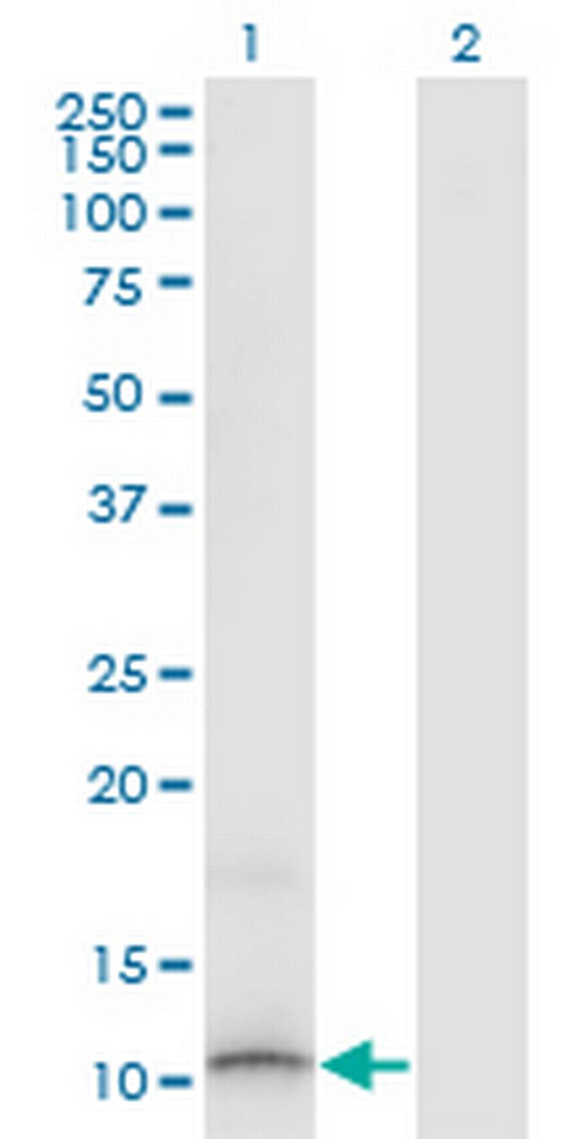 SLURP1 Antibody in Western Blot (WB)