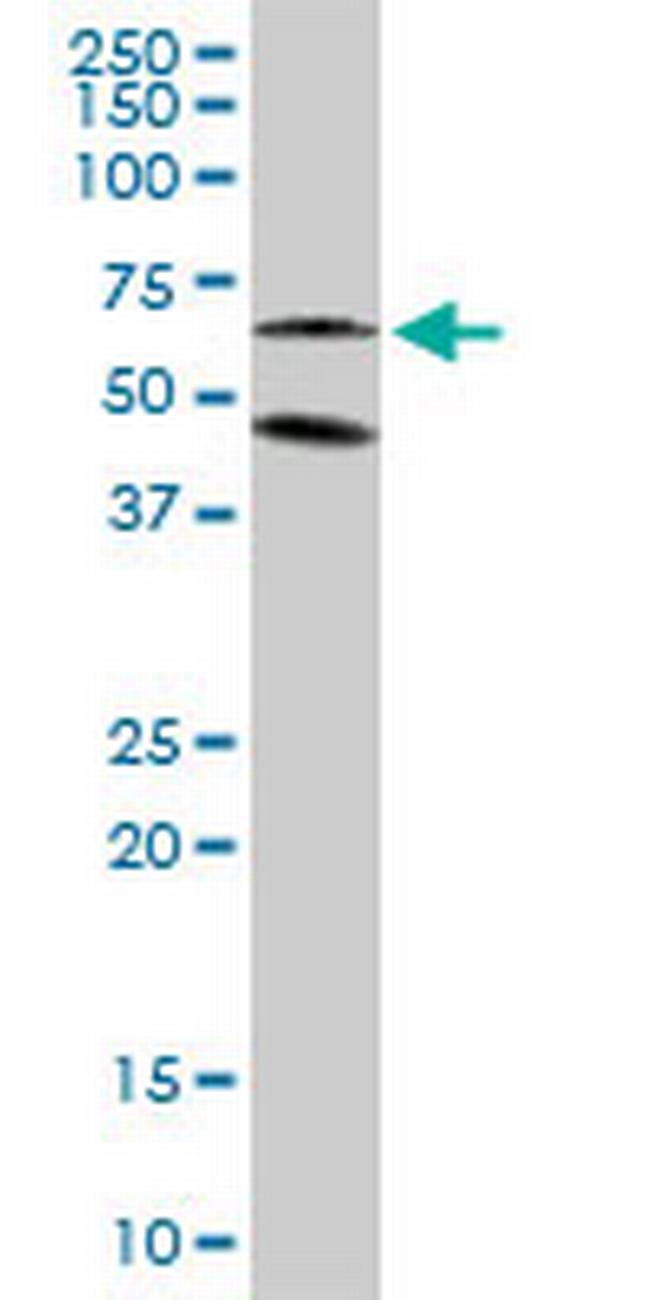 CAMK1G Antibody in Western Blot (WB)
