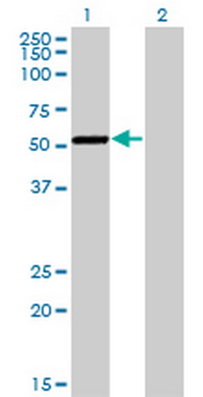 CAMK1G Antibody in Western Blot (WB)