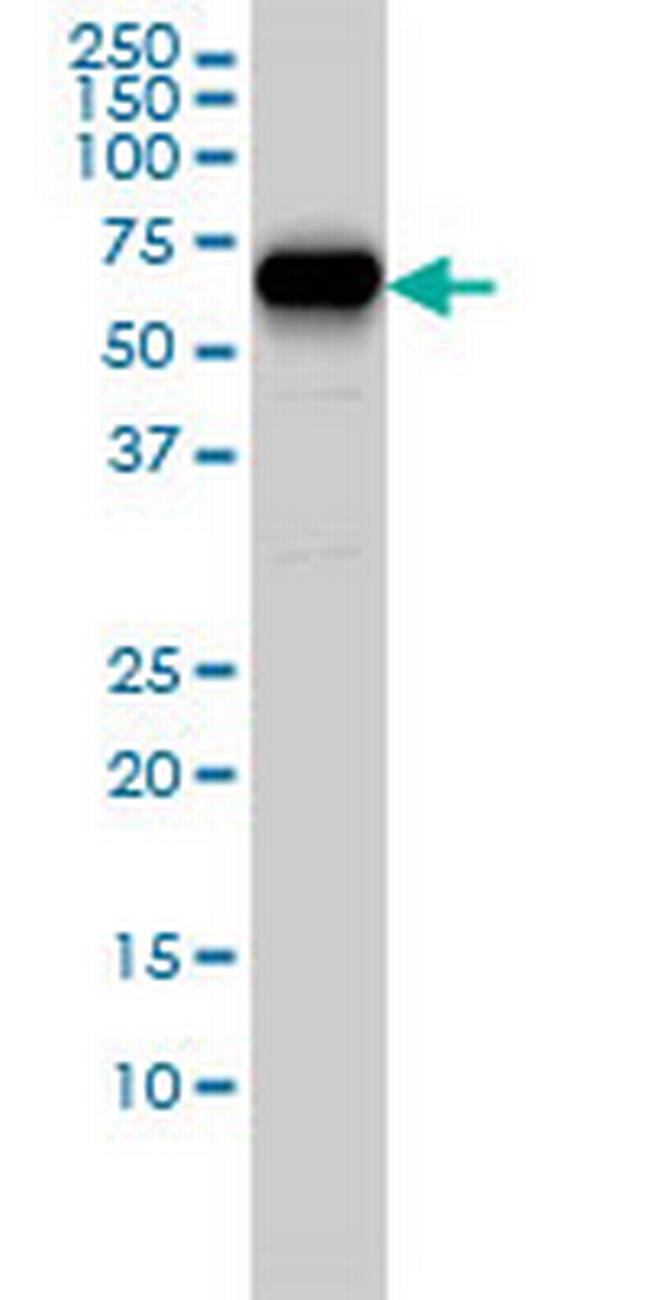 CORO1B Antibody in Western Blot (WB)