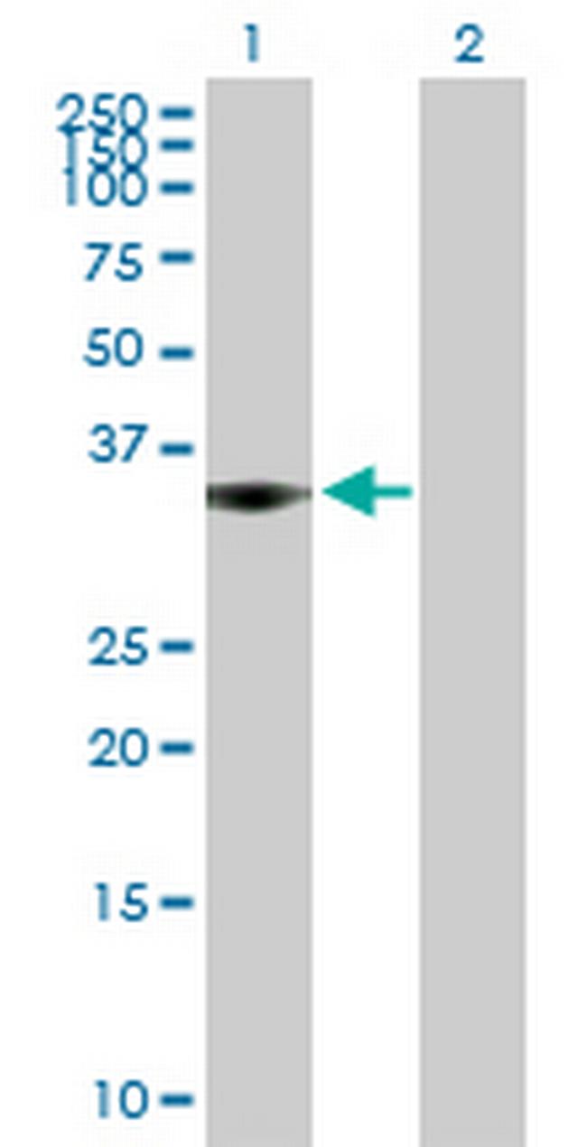 NPAL3 Antibody in Western Blot (WB)