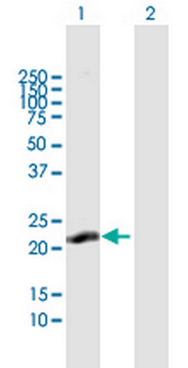 C13orf1 Antibody in Western Blot (WB)