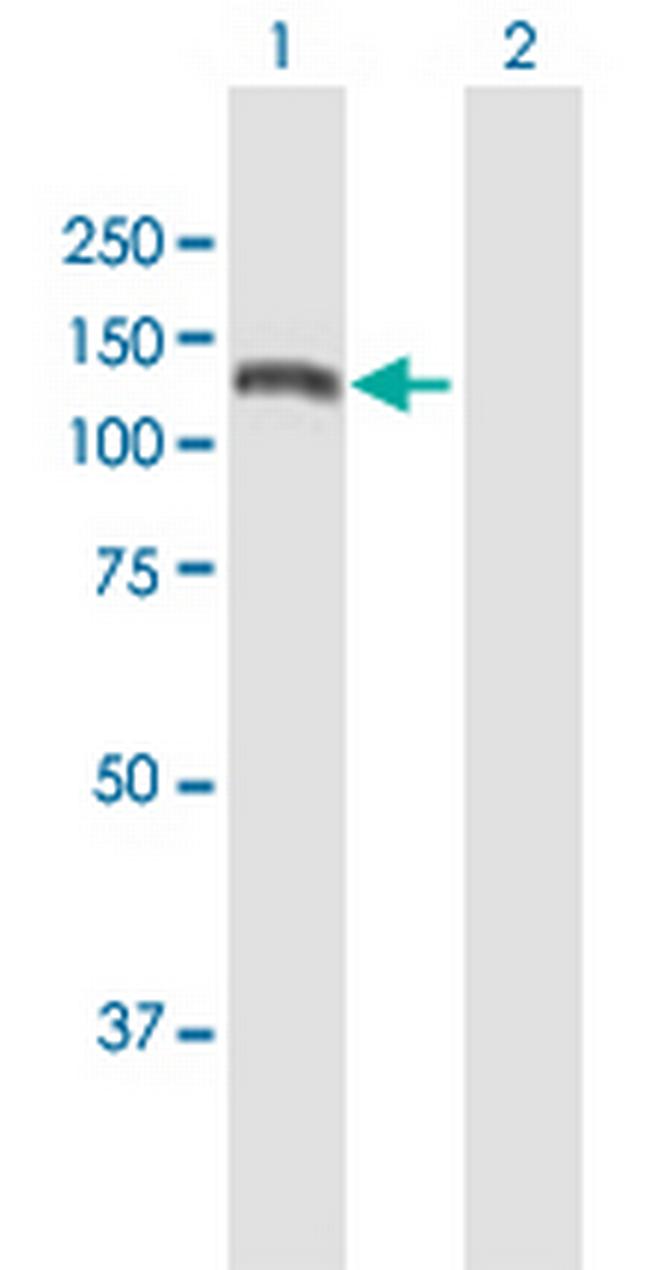 KIAA1199 Antibody in Western Blot (WB)
