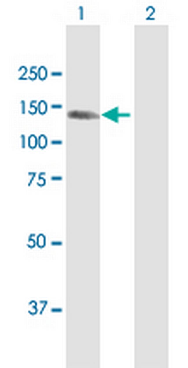 KIAA1199 Antibody in Western Blot (WB)