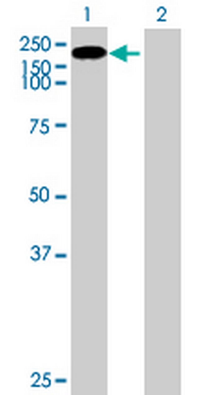 CSRP2BP Antibody in Western Blot (WB)