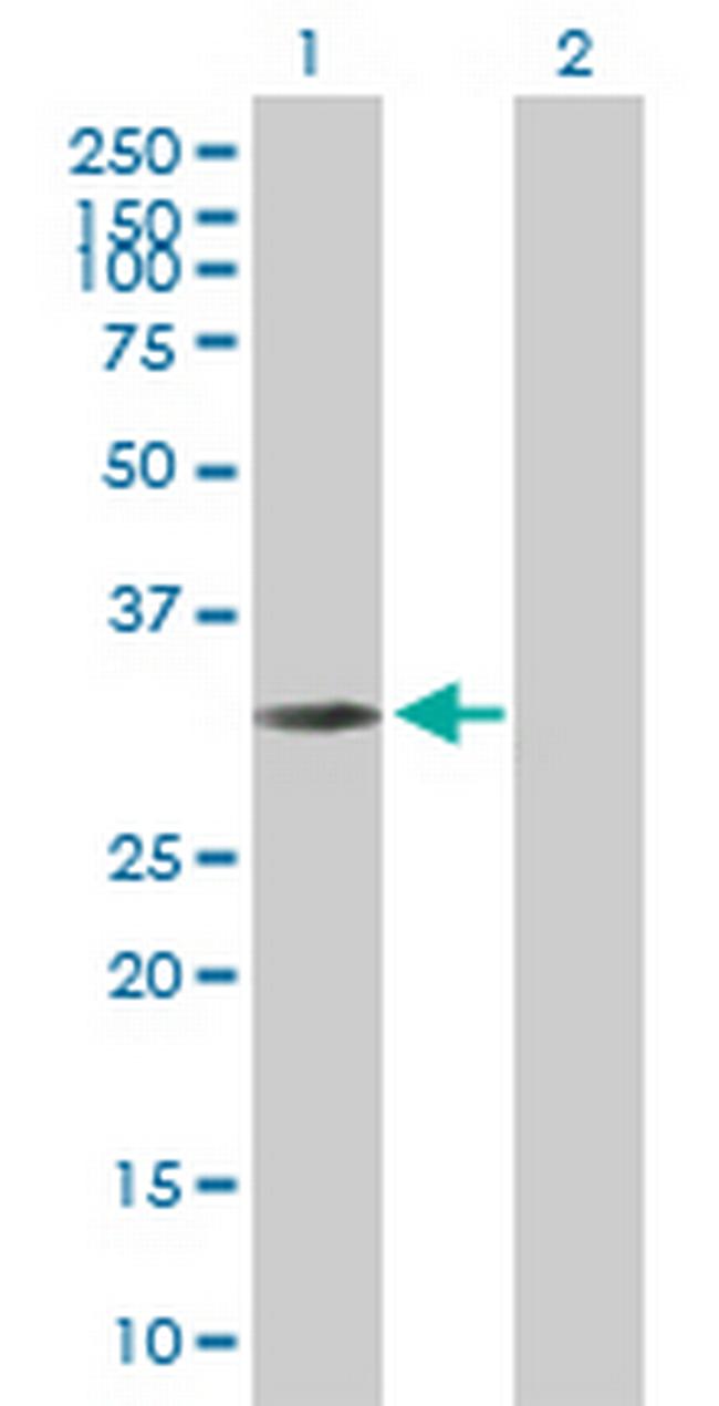 NMRAL1 Antibody in Western Blot (WB)