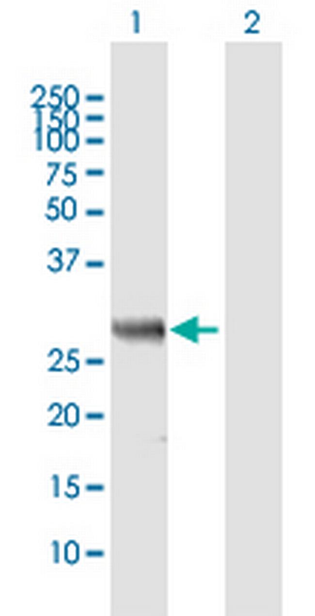 MIF4GD Antibody in Western Blot (WB)
