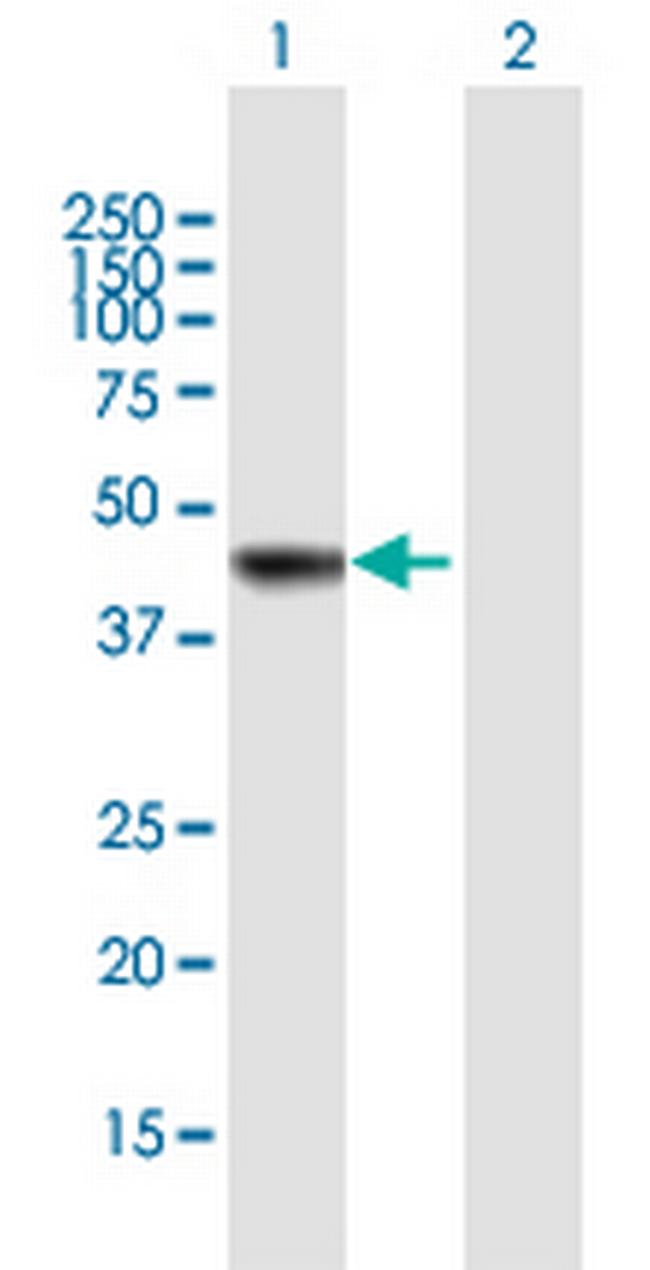 AS3MT Antibody in Western Blot (WB)