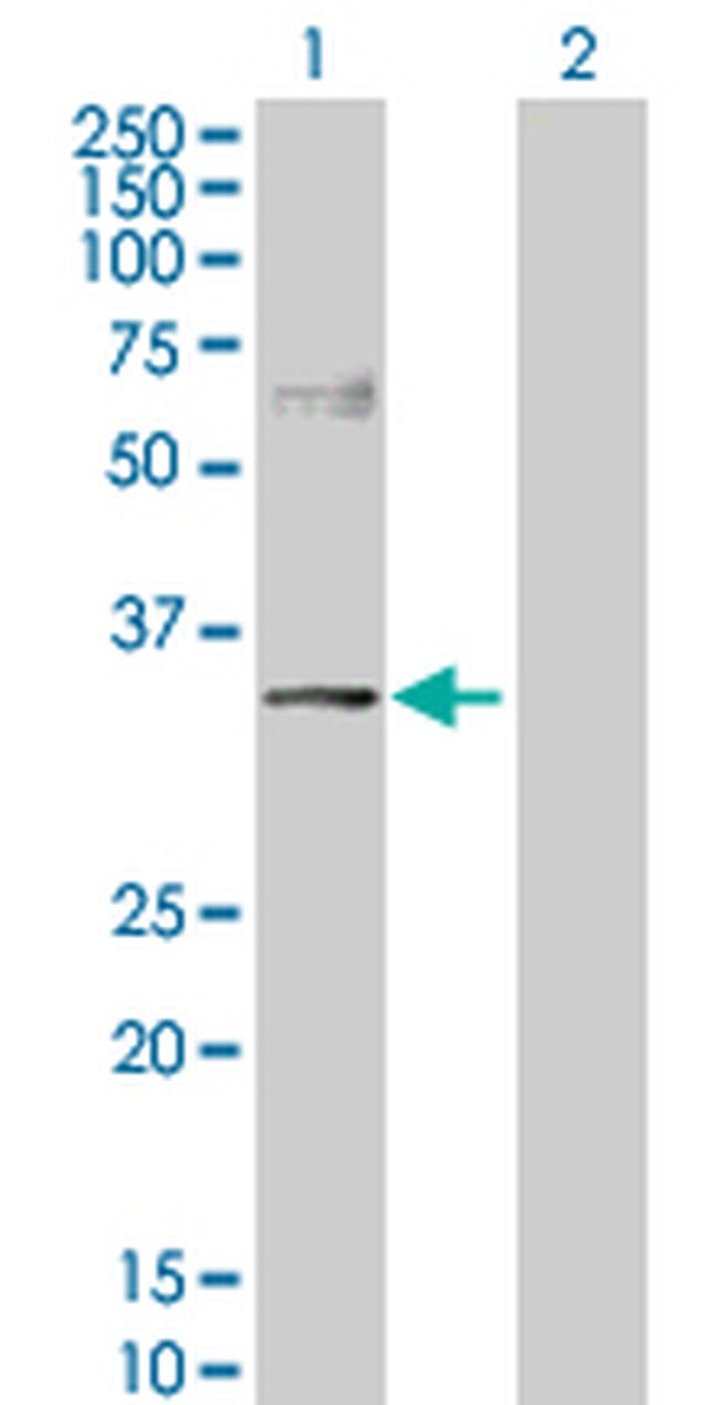 NDRG2 Antibody in Western Blot (WB)