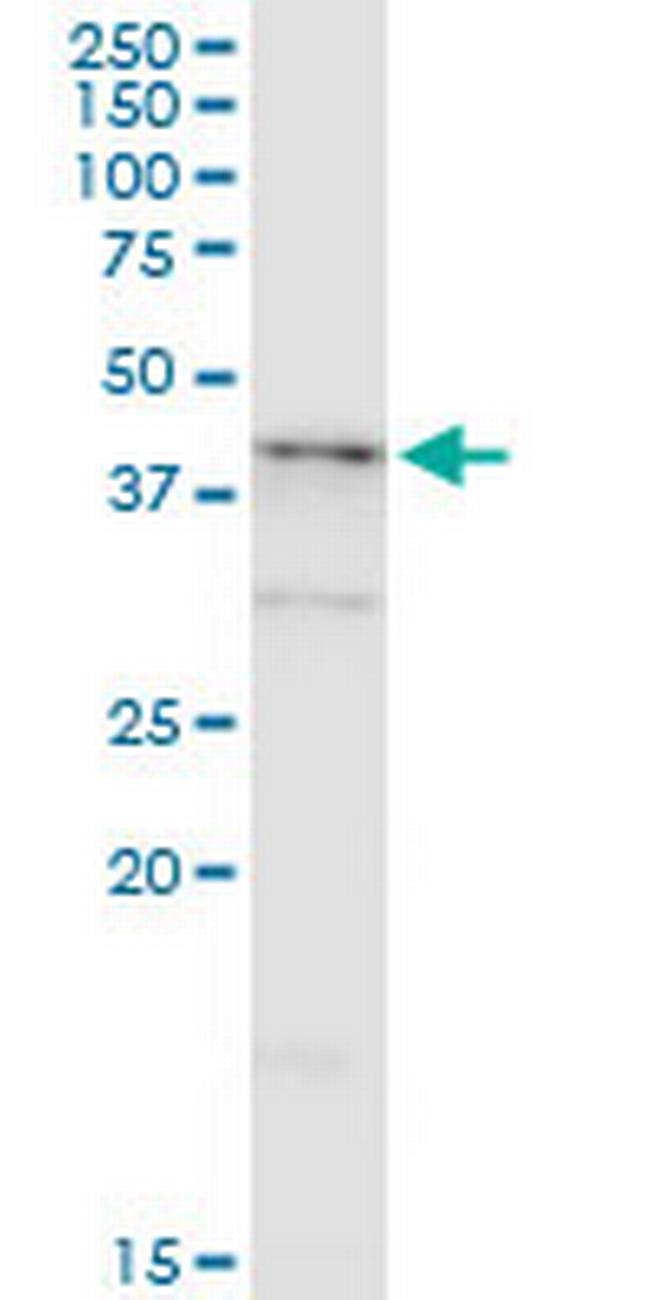 NDRG2 Antibody in Western Blot (WB)