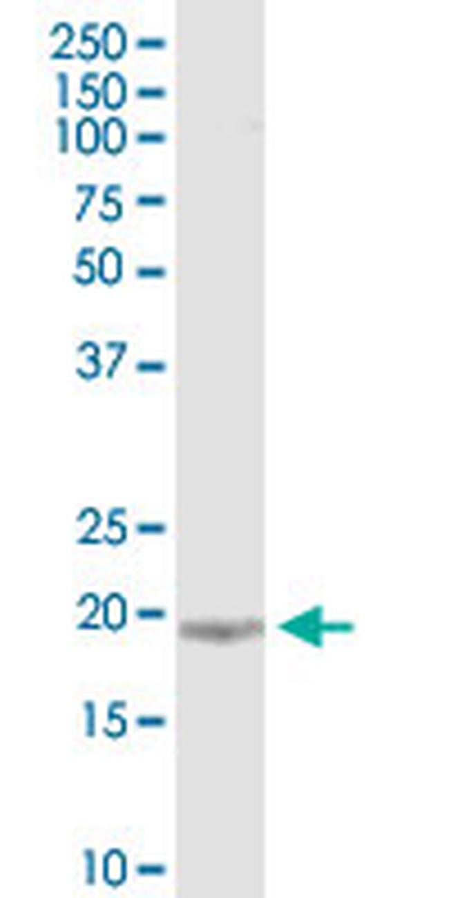 KIAA1143 Antibody in Western Blot (WB)