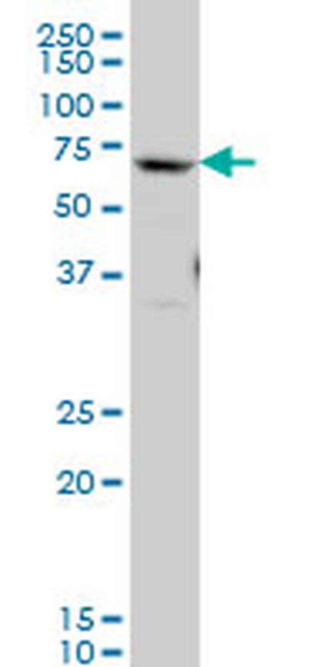GATAD2B Antibody in Western Blot (WB)