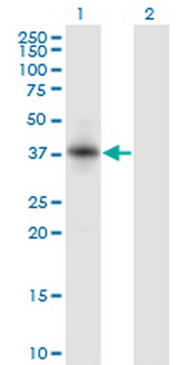 RNF150 Antibody in Western Blot (WB)