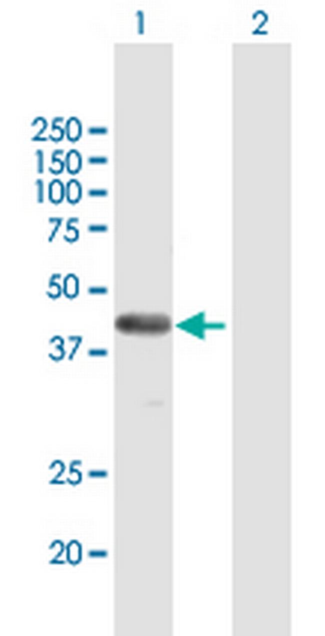 FAM62B Antibody in Western Blot (WB)