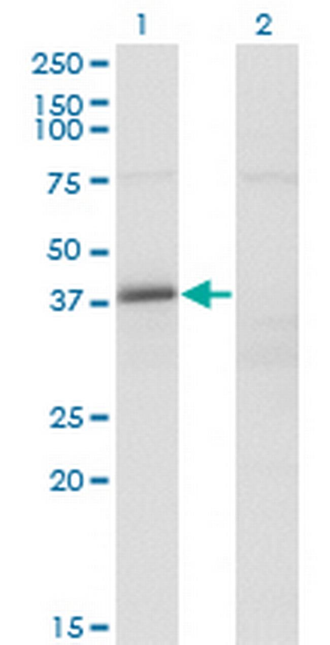 FAM62B Antibody in Western Blot (WB)