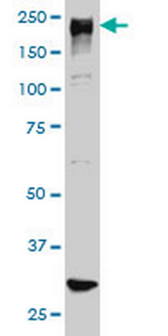 ARID1B Antibody in Western Blot (WB)
